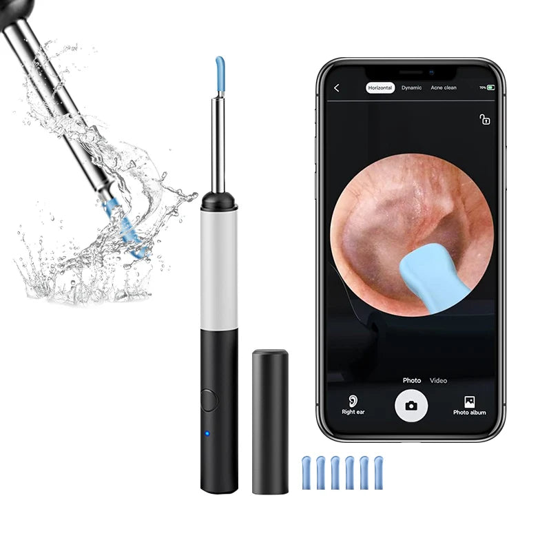 Ear Wax Removal Wireless Intelligent Visual Ear Picker 1080P 3.9MM HD Otoscope with 6 LED Ear Cleaner for iOS & Android