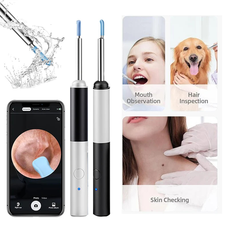 Ear Wax Removal Wireless Intelligent Visual Ear Picker 1080P 3.9MM HD Otoscope with 6 LED Ear Cleaner for iOS & Android